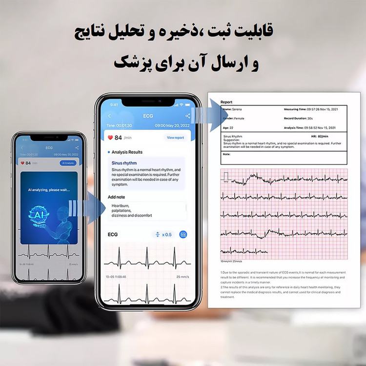 فشارسنج بازویی دیجیتال ولو مدل Armfit Plus با قابلیت اندازهگیری فشار خون، ضربان قلب و نوار قلب، اتصال بلوتوث و اپلیکیشن، تشخیص آریتمی، حافظه 60-31 رکورد و نمایشگر LCD